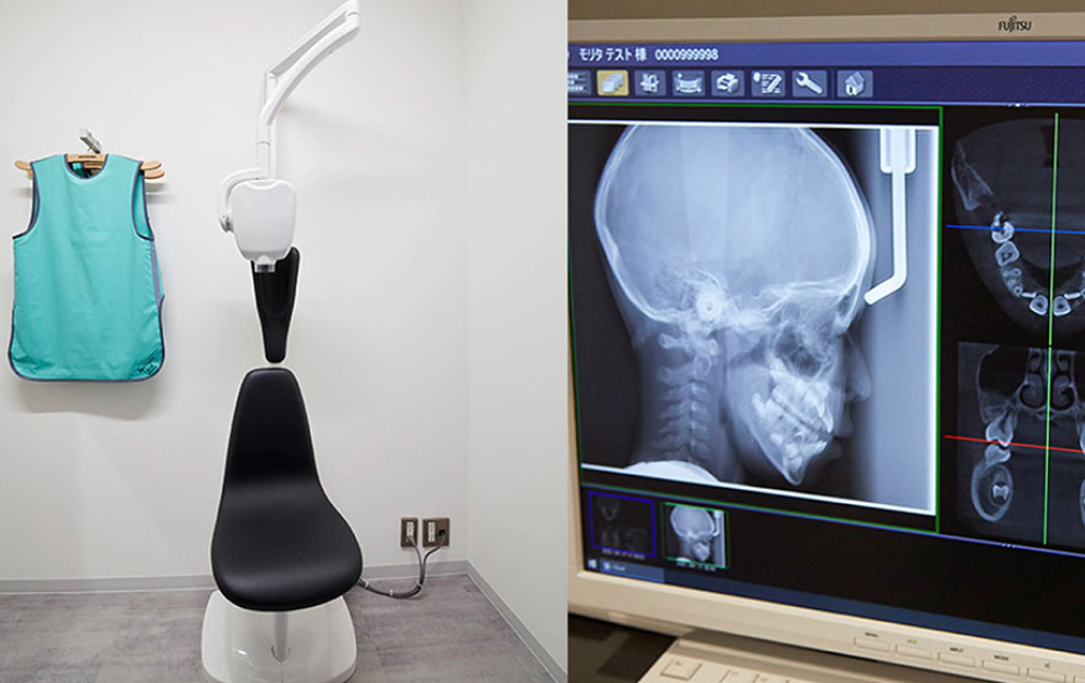 新しいデジタルX線装置でインプラントの外科手術に対応
