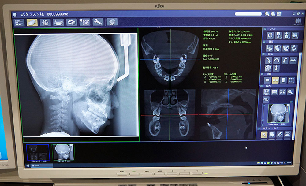 頭部X線規格写真