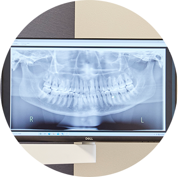 精緻な治療を実現する検査設備