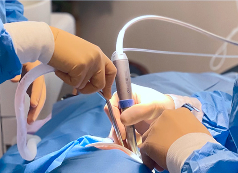 繊細に治療を進めるバリオサージ